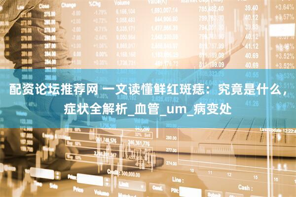 配资论坛推荐网 一文读懂鲜红斑痣：究竟是什么，症状全解析_血管_um_病变处